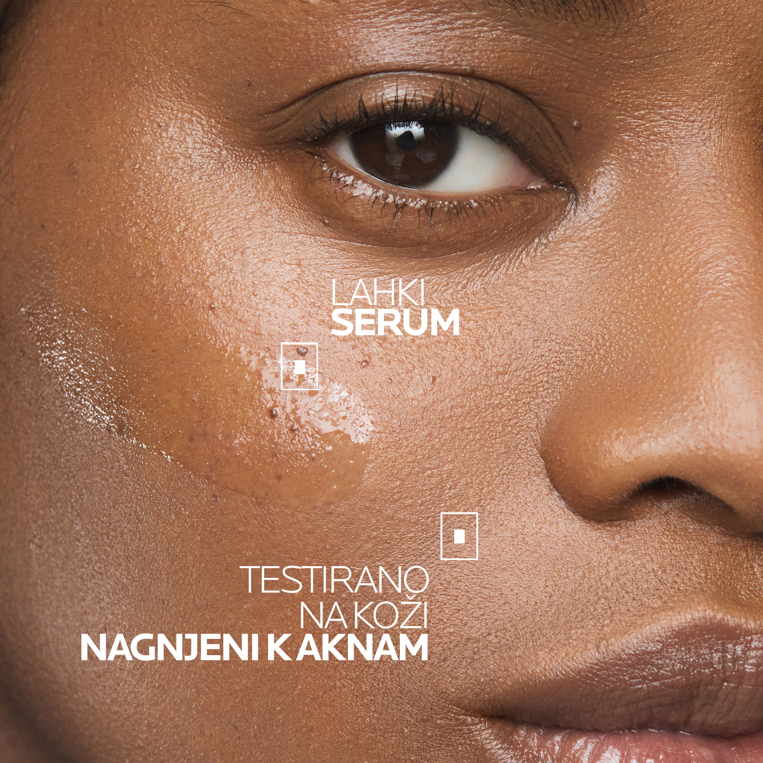 Effaclar Ultra koncentrirani serum za aknasto kožo – La Roche-Posay, 30 ml