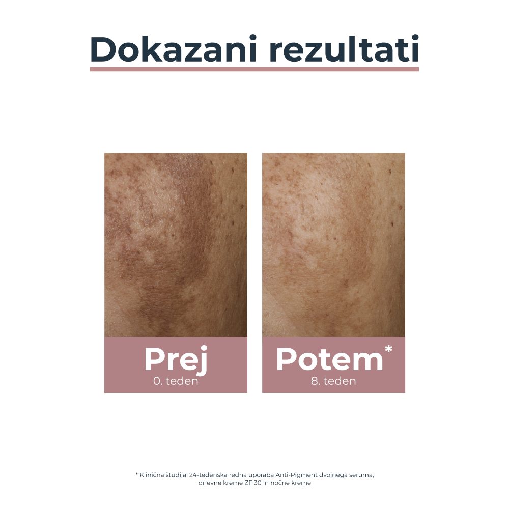 Eucerin Anti-Pigment dnevna krema ZF30, 50 ml