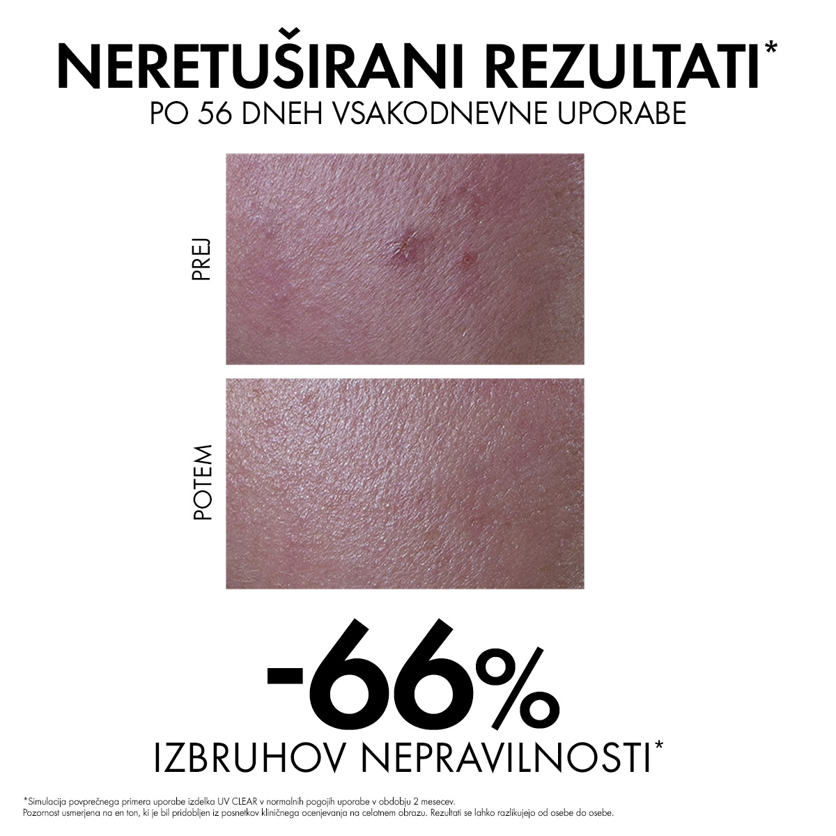 Vichy Capital Soleil UV-Clear fluid za zaščito pred soncem proti nepravilnostim ZF 50+, 40 ml