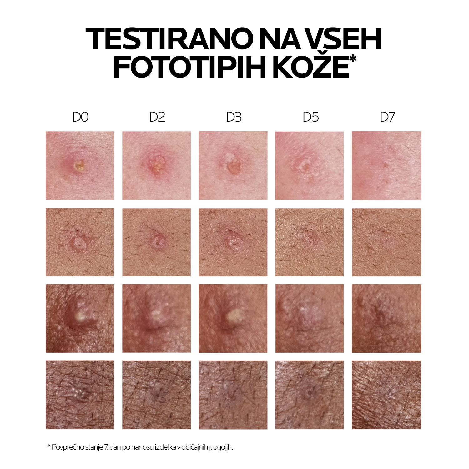 Effaclar Duo (+) M vlažilna gel krema z učinkom matiranja – La Roche-Posay, 40 ml