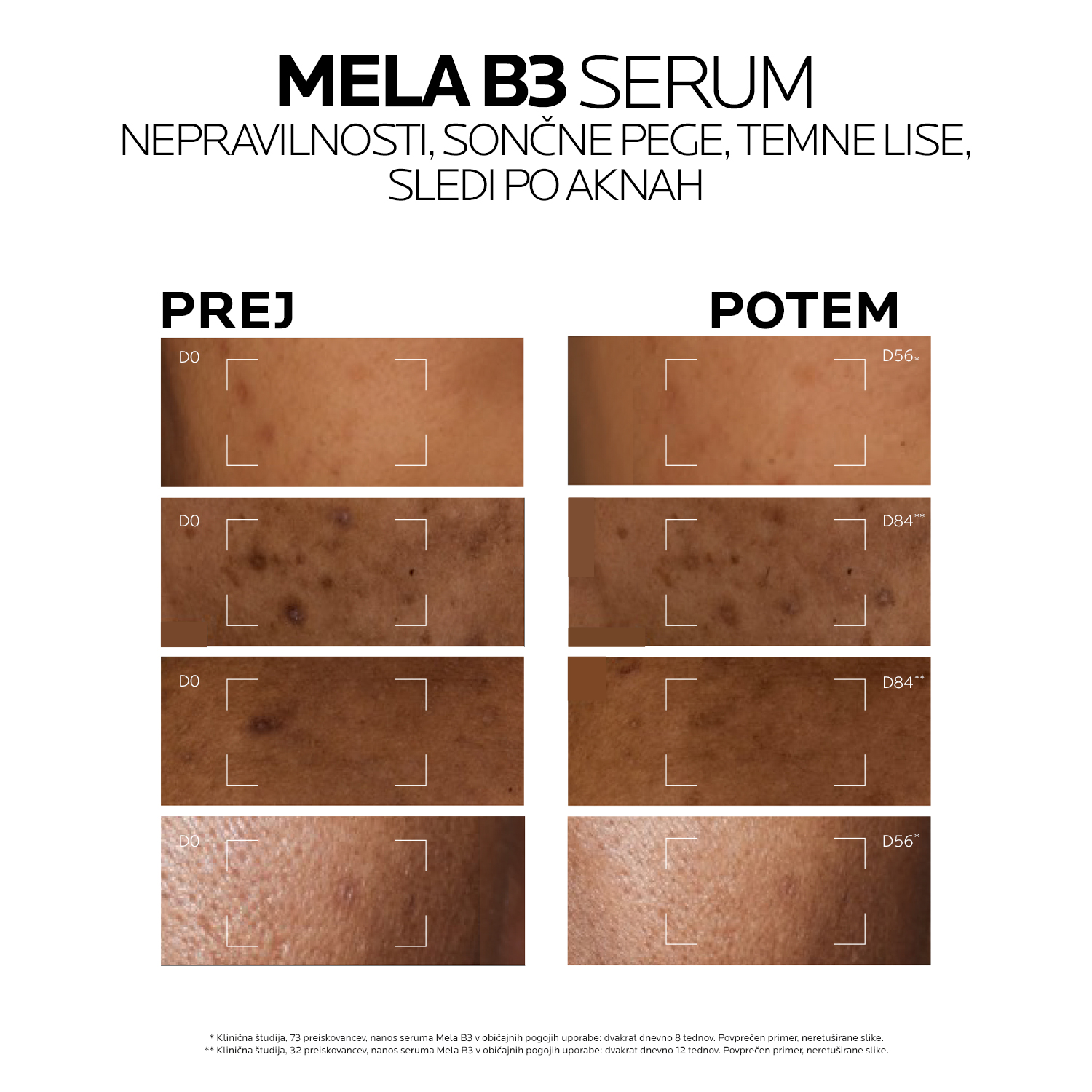 Mela B3 serum proti temnim lisam in njihovim ponovitvam – La Roche-Posay, 30 ml
