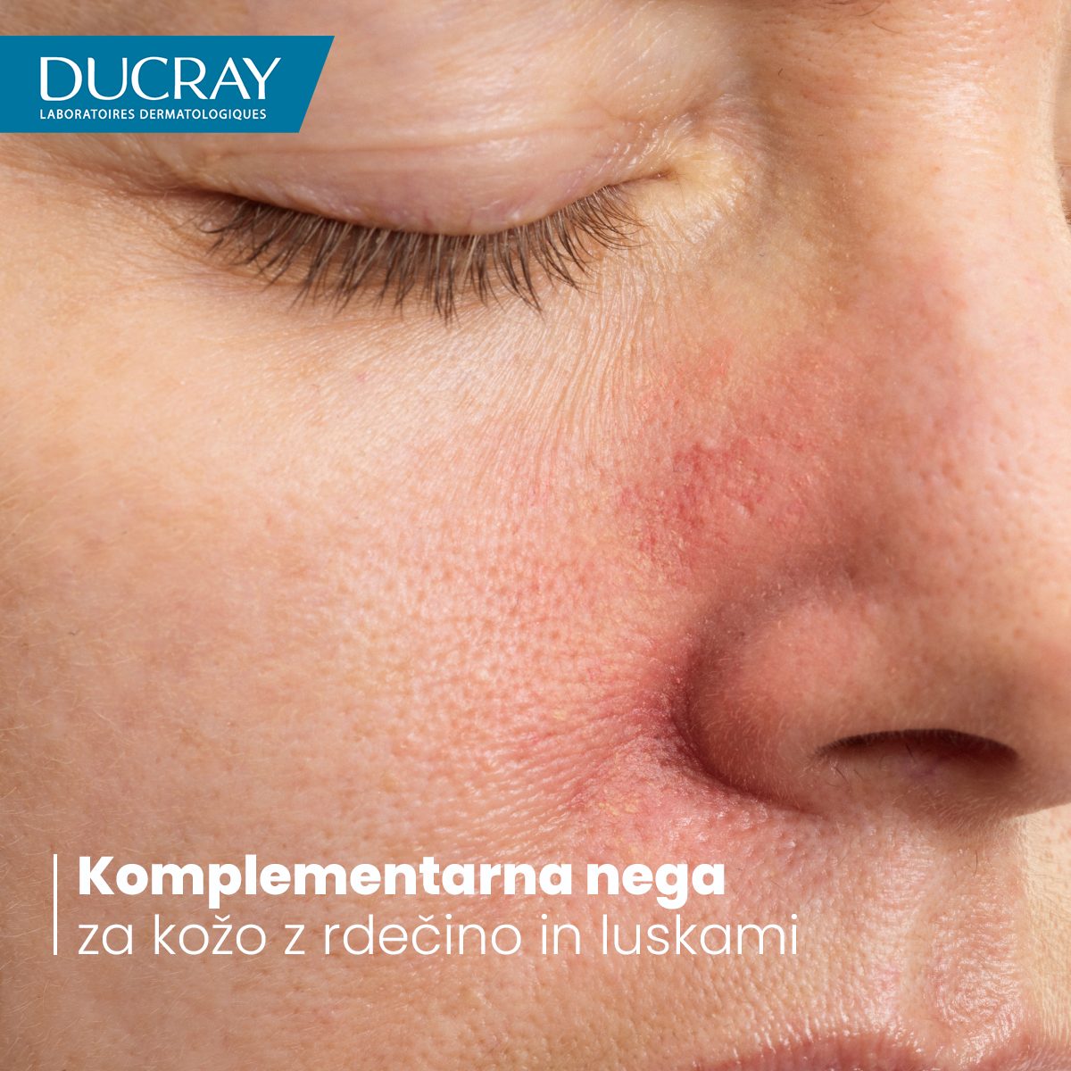 Ducray Kelual DS pomirjujoča krema, 40 ml