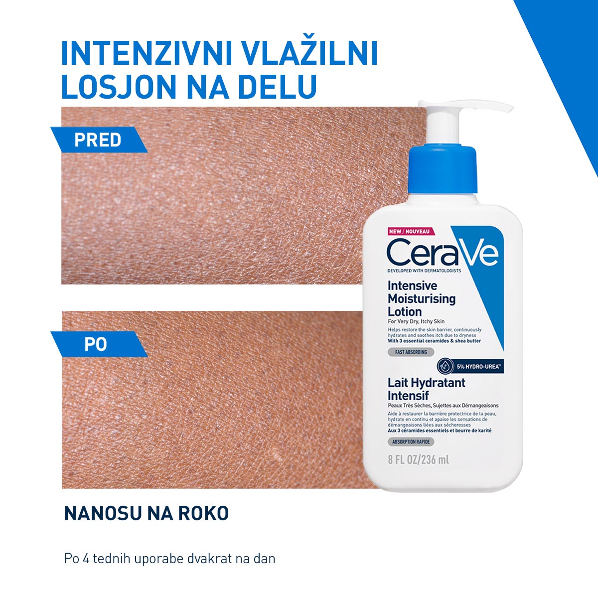 CeraVe Intenzivni vlažilni losjon za suho in zelo suho kožo s hydro-ureo, 236 ml