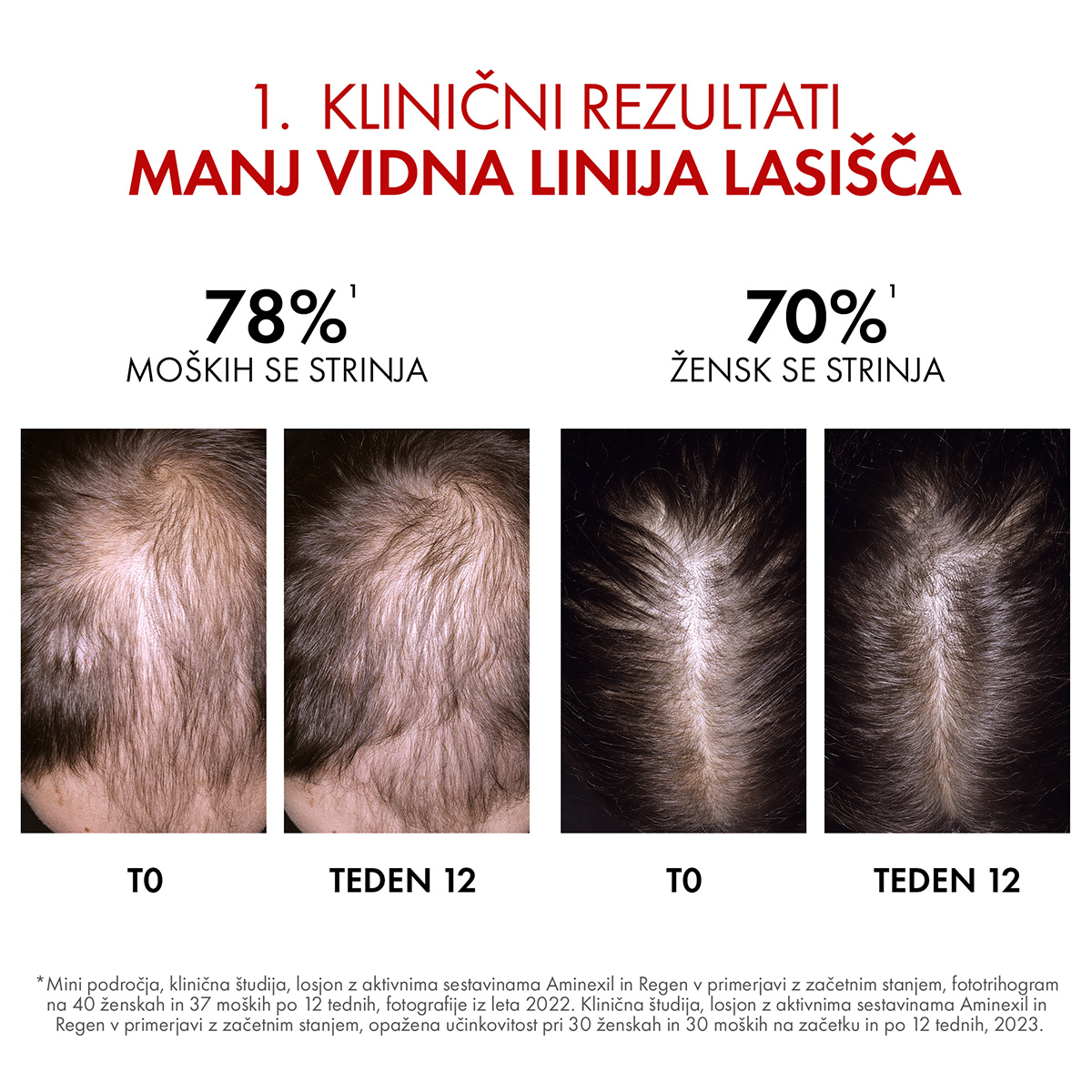 Vichy Dercos Aminexil Clinical R.E.G.E.N. booster serum za obnovo las, 90 ml