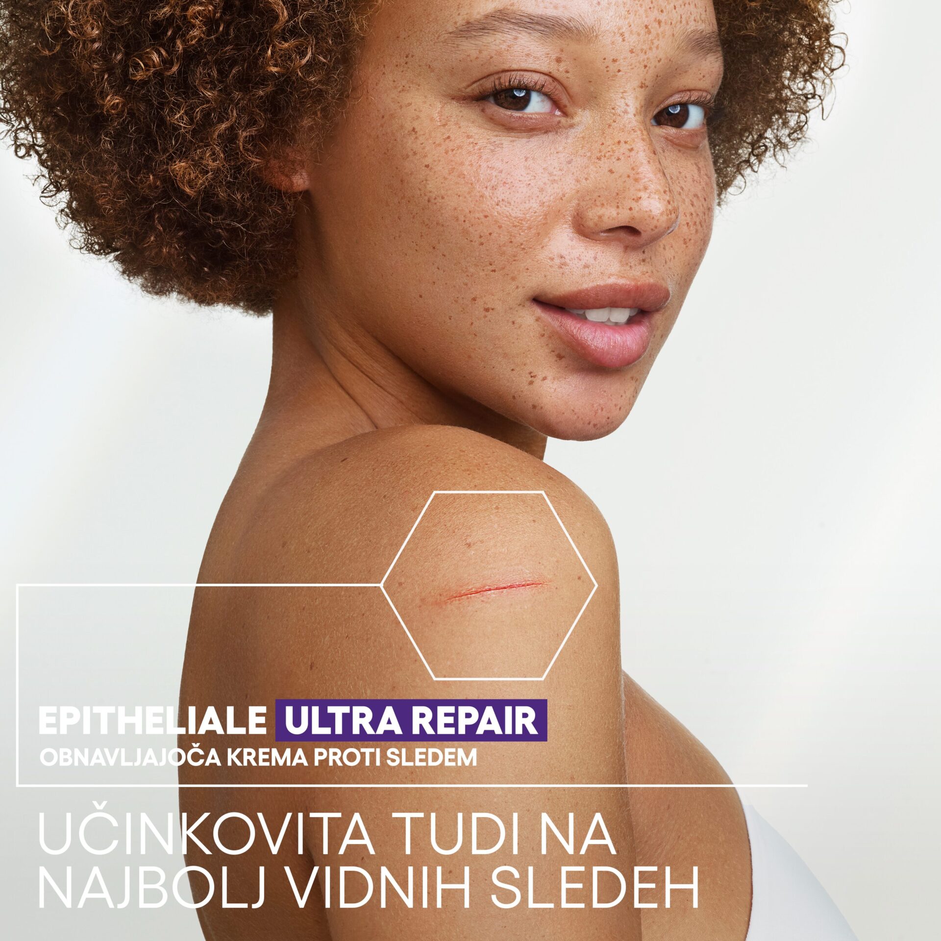 A-Derma Epithelial Ultra Repair obnavljajoča krema proti sledem, 40 ml