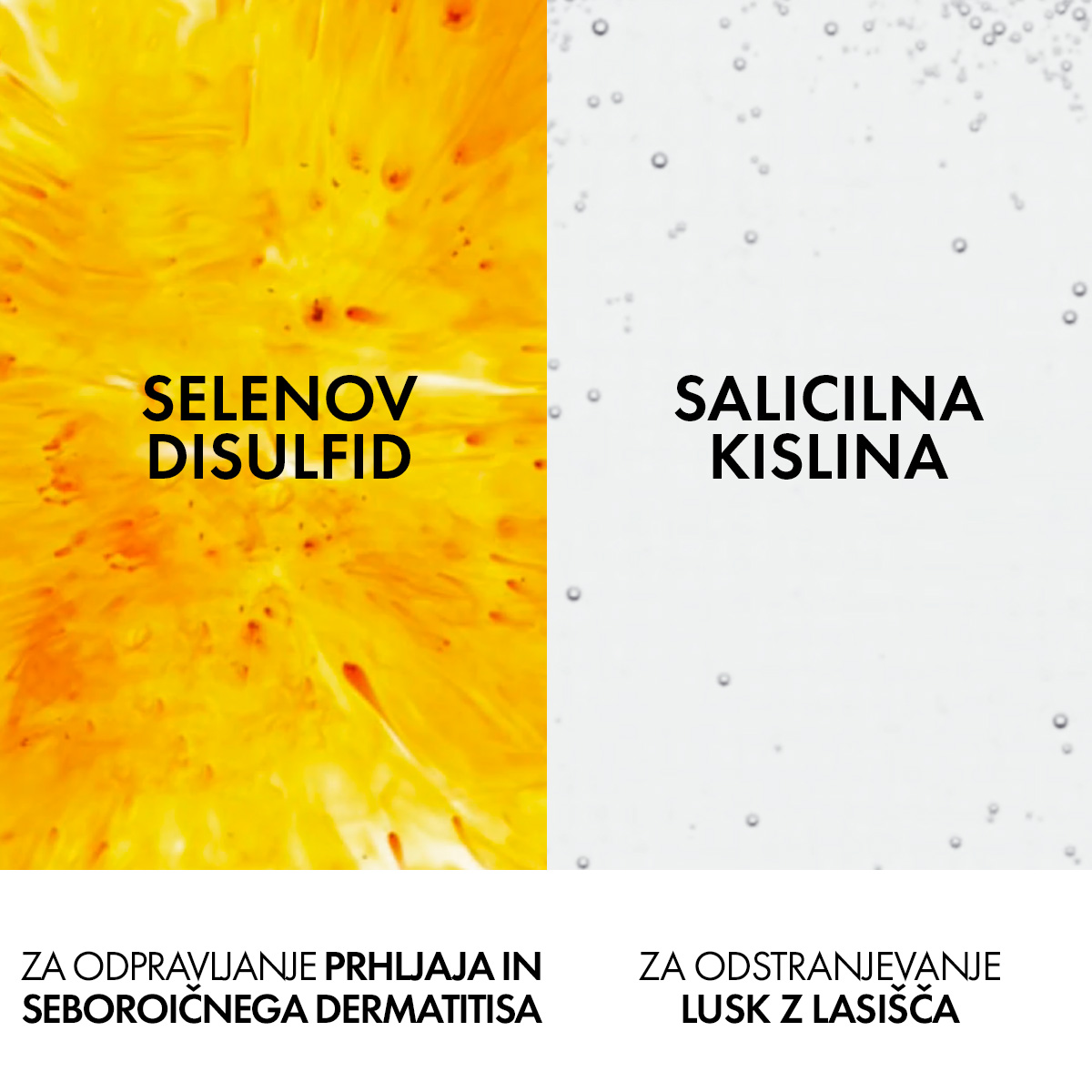 Vichy Dercos šampon proti prhljaju za suhe lase, 390 ml refill