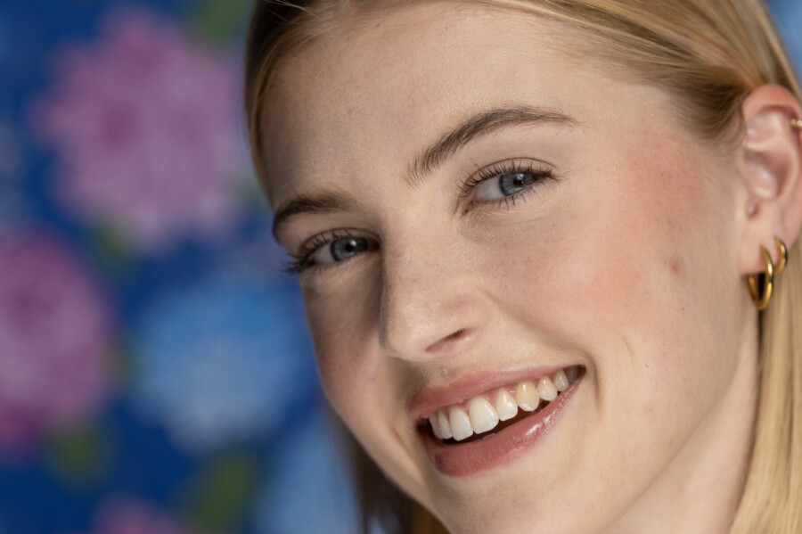 Nexcare Acne Patch obliži za akne, 15 obližev