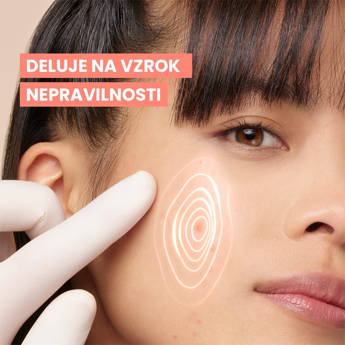 Avène Cleanance Comedomed+ intenzivna nega proti nepravilnostim, 30 ml