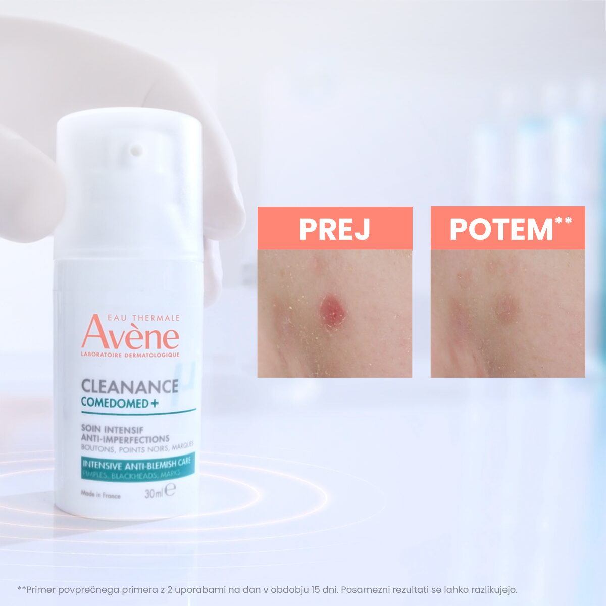 Avène Cleanance Comedomed+ intenzivna nega proti nepravilnostim, 30 ml